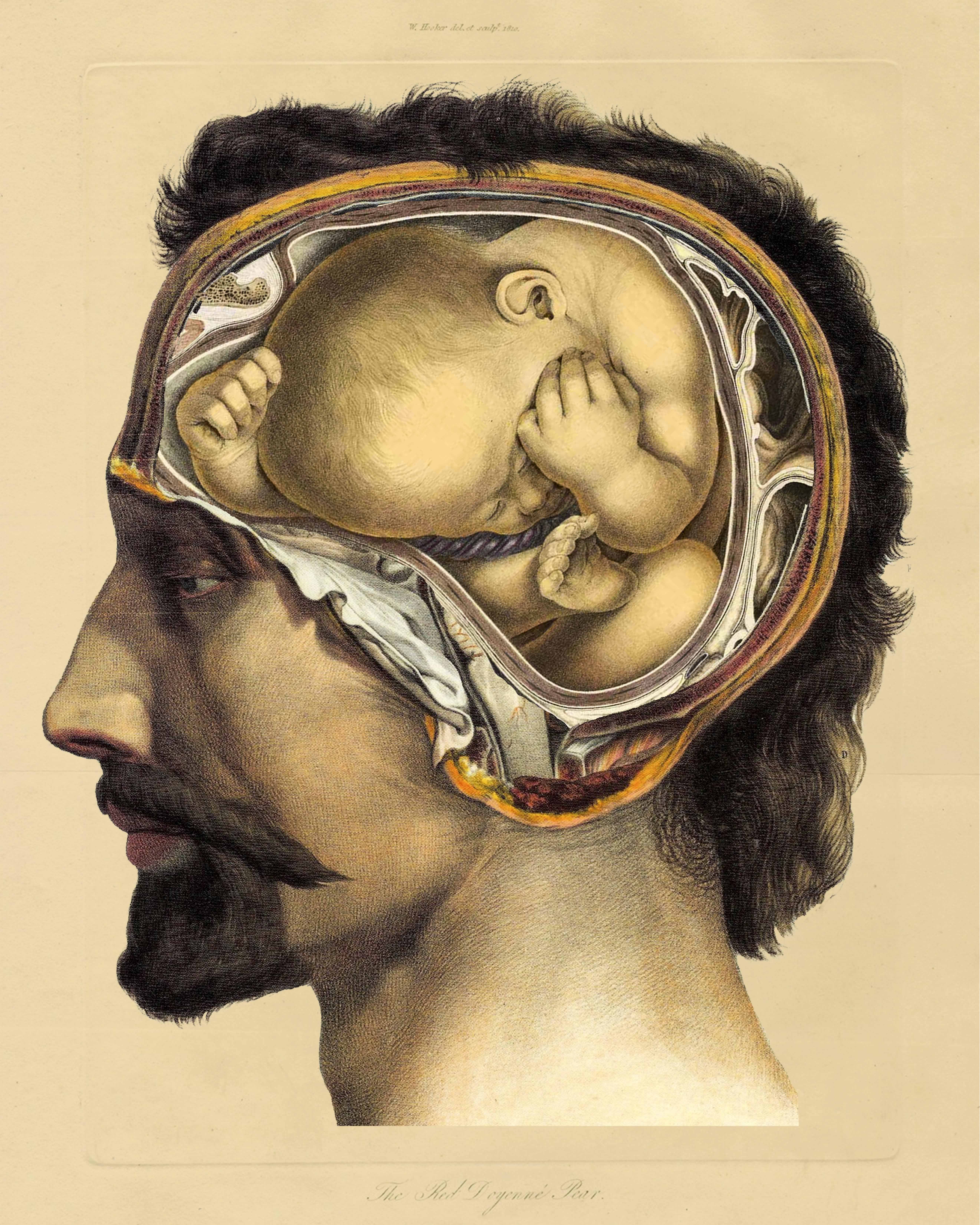 baby brain small